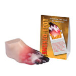 27029 Smoked Foot Gangrene Model WEB
