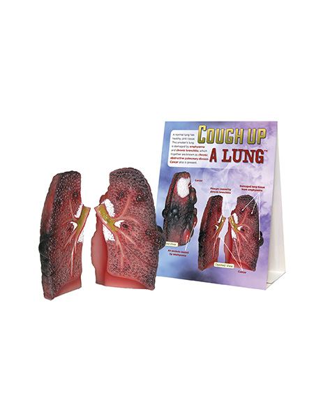 Cough Up a Lung Model