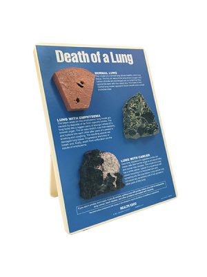 Death of a Lung Easel Display