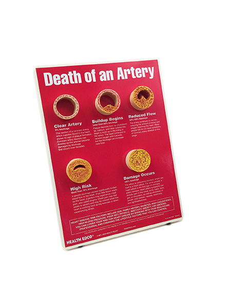 Death of an Artery Easel Display