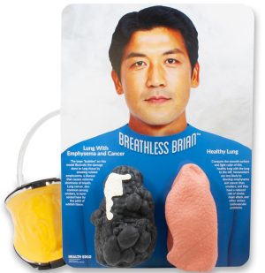 Breathless Brian Smoker's Lungs Comparison Model